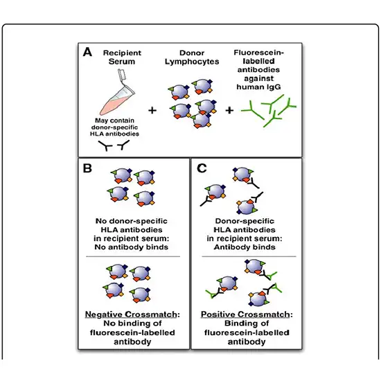 HLA, T and B Cell Flow Cytometry Crossmatch